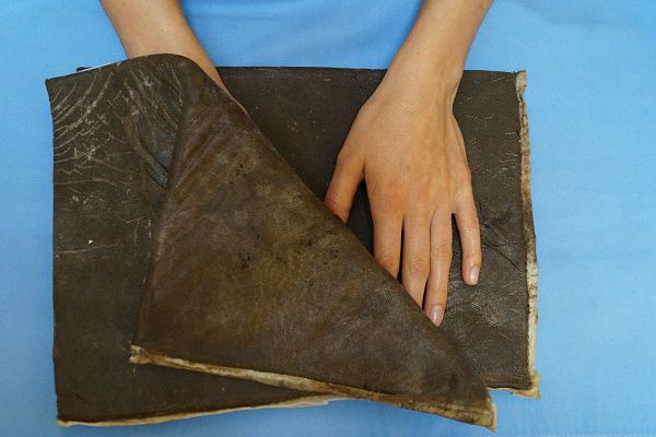 Грязелечение (теплолечение)